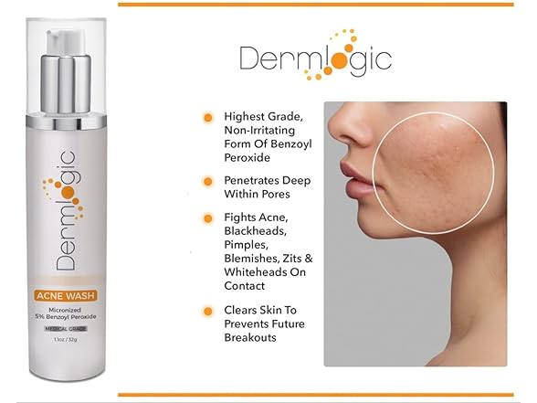 Dermlogic Acne Treatment