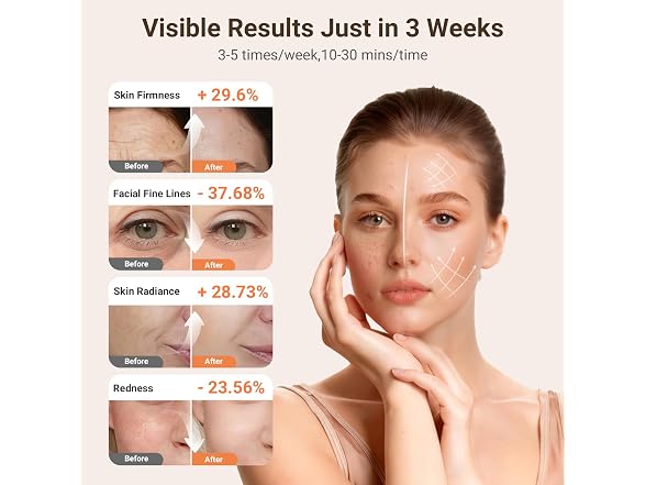 Gleelar 2026 Red Light Therapy Mask