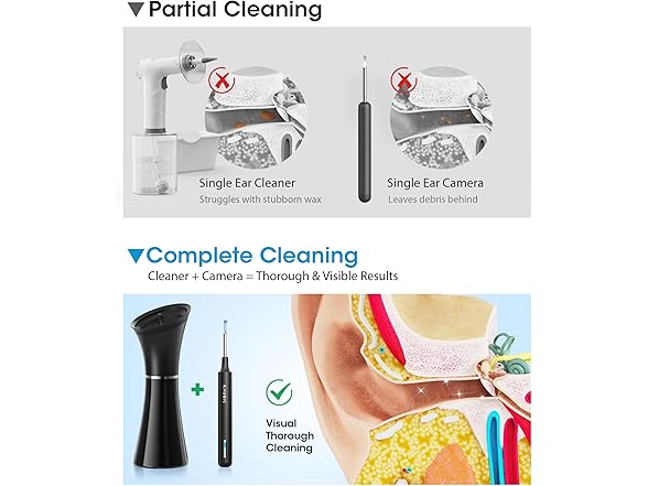 KAUGIC Ear Wax Removal Tool with Camera