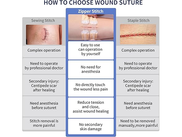 Emergency Wound Closure Device