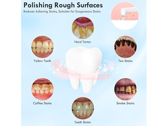 Rechargeable Teeth Polisher 5 Speed