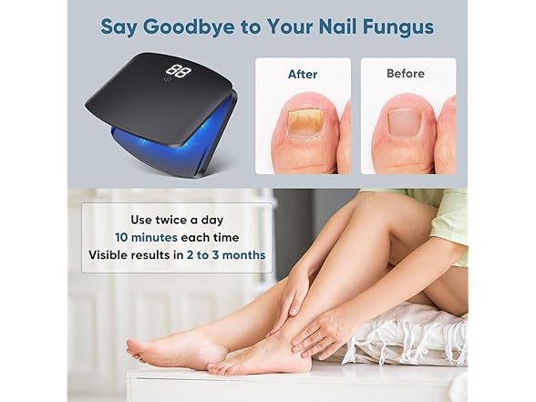 Nail Fungus Light Device
