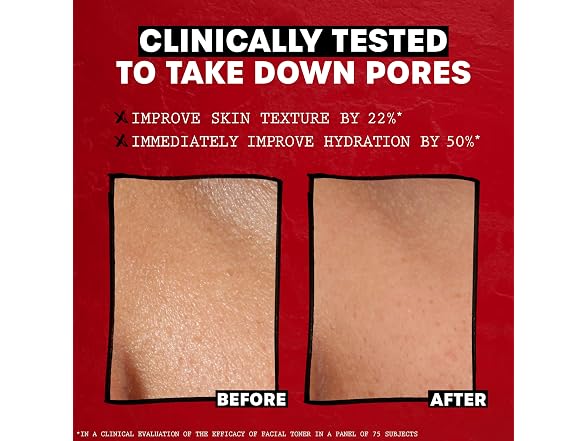 THAYERS Alcohol-Free, Hydrating, Unscented Witch Hazel Facial Toner