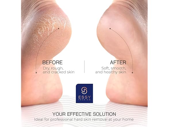 Essy Electric Foot File