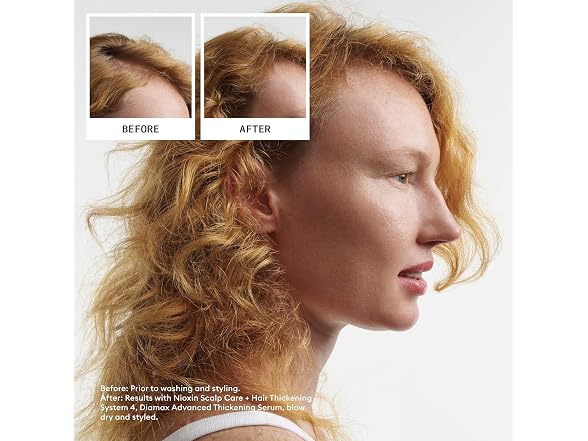 Nioxin System 4 Hair Thick Colored and Damaged