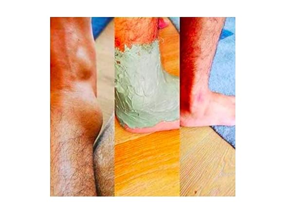 Skateboarders relief