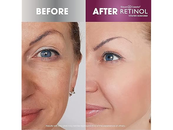 (3 Pack) Retinol Anti-aging Gold Peel-off Mask 3.4 oz.