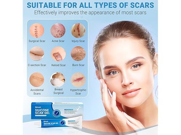 Kunyle BC521525090026 silicone scar gel