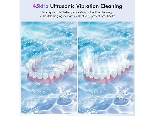 Raccomb 250ML Retainer Cleaner