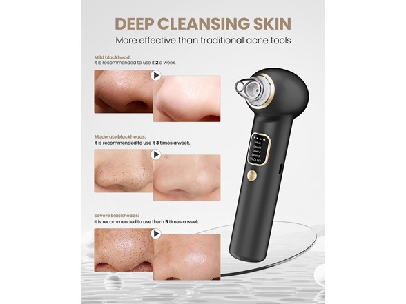 YAGETU BC1192925100001 blackhead remover