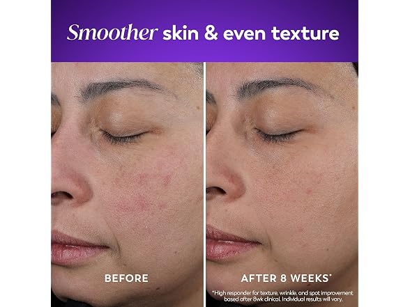 Olay Retinol Night Cream 1.7oz