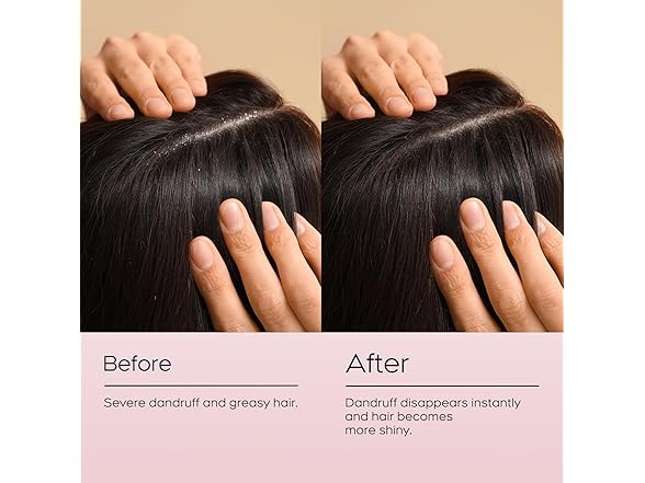 Itch Relief Anti-Fungal Shampoo