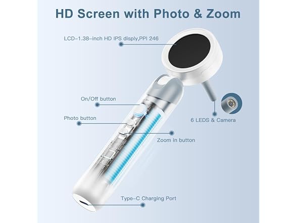ASPOVEN 1080P HD Otoscope Ear Camera