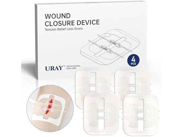 URAY  Emergency Wound Closure Device