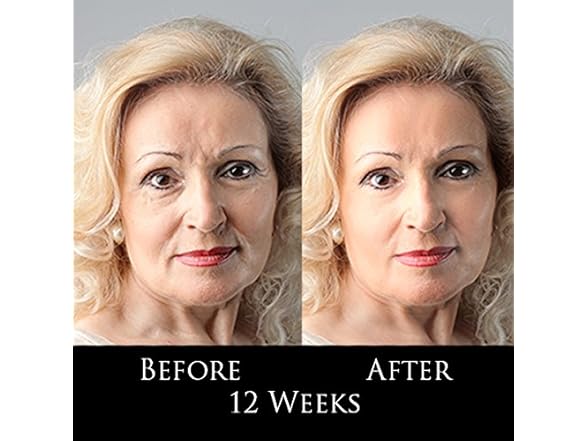 TRESDIANA DMAE Anti-Aging Moisturizer