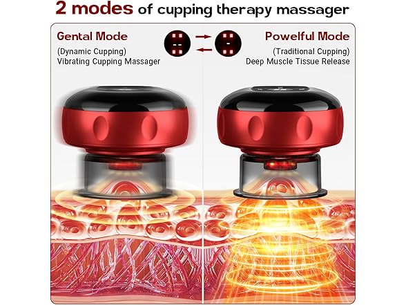(2 Pack) Smart Cupping Set
