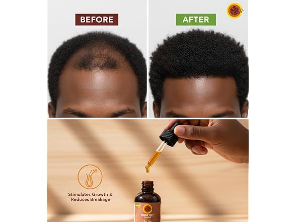 Tropic Isle Living Castor Oil Hair Growth 3x