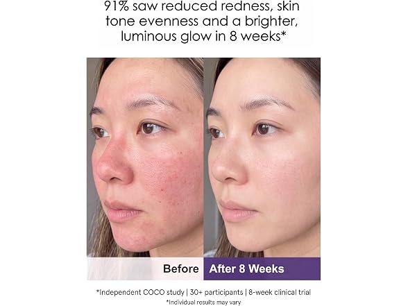 COCO CORALIA Red Light Therapy Mask