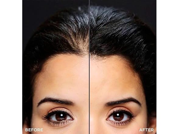 Toppik Hairline Optimizer, 5 Pack