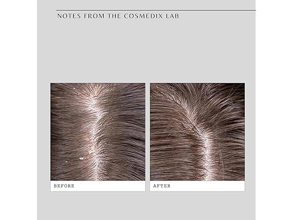 CosMedix Fortify Cooling Enzyme Scalp Treatment, 3.7 oz