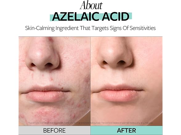 RECIPE Azelaic Acid 10 Soothing Ampoule -