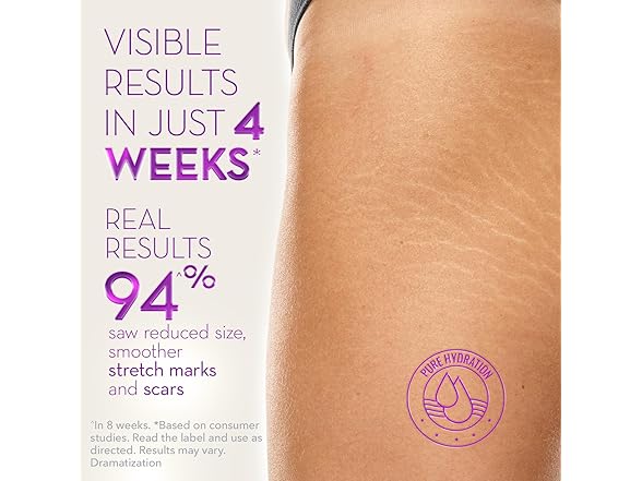 Cicatricure Cicatricure Cica Oil for Stretch Marks &