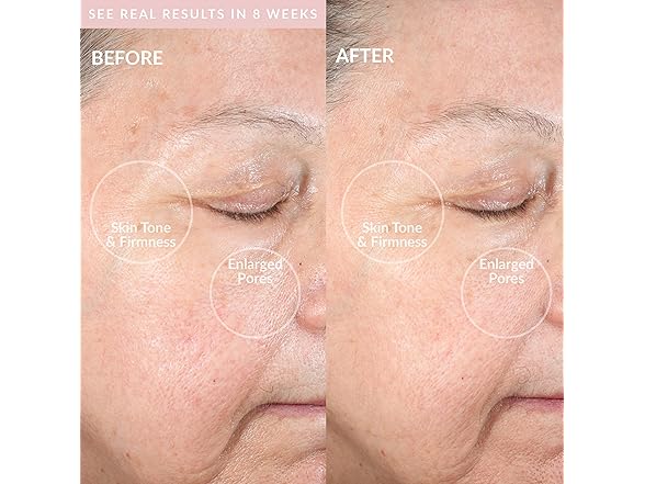 PMD Beauty Clean Pro - Electric Facial Cleansing Brush