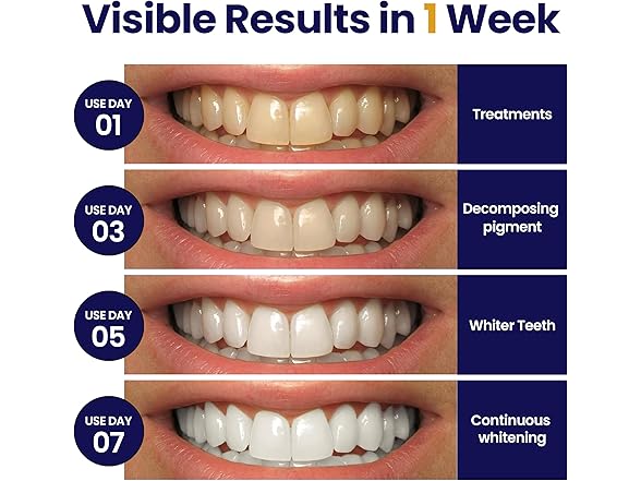 DENTELO Teeth Whitening Strips, 28 Strips