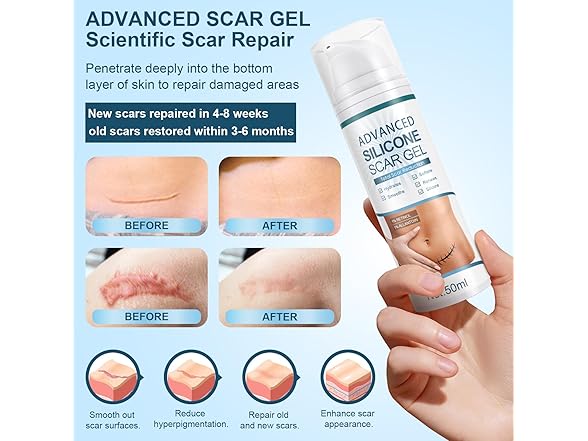 Mitgary Scar Gel Scar Cream