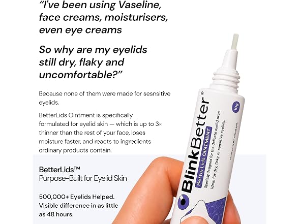 BlinkBetter BetterLids Eyelid Ointment Dry Itchy