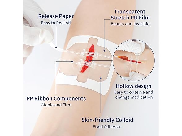 URAY  Emergency Wound Closure Device