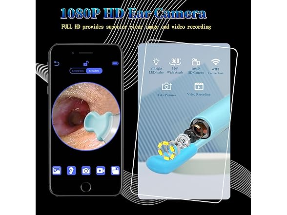Wikups Ear Wax Removal