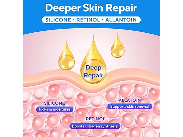 Tuoharliy Silicone Scar Gel