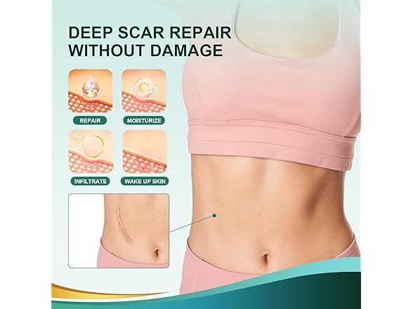 Gowgaw Medical Grade Silicone Scar Sheets
