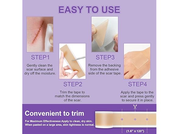 Mitgary Medical Grade Silicone Scar Tape