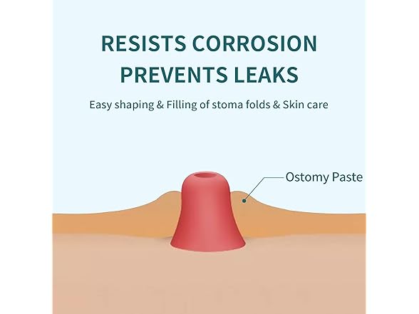 ovand Ostomy Filler Paste for Ostomy