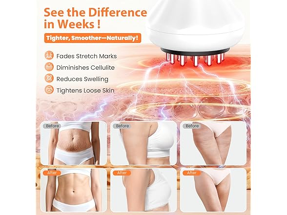 NENRENT Body Sculpting Machine