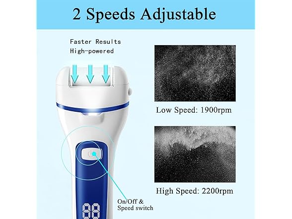 13-in-1 Electric Foot Callus Remover