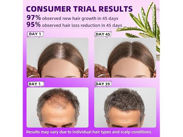Pipuxi 5% Minoxidil Hair Growth Products