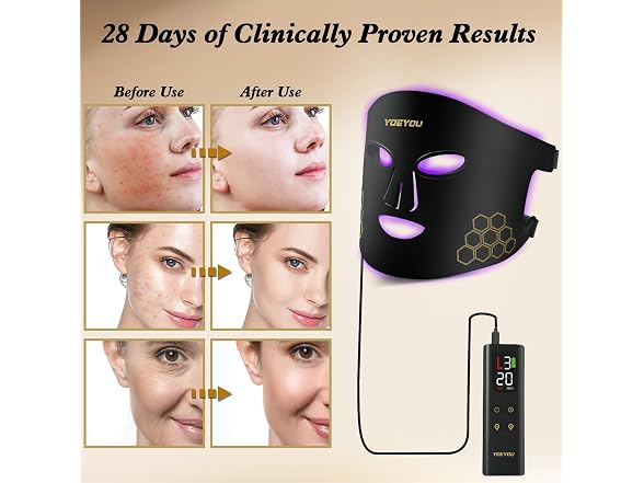 Red Light Therapy for Face