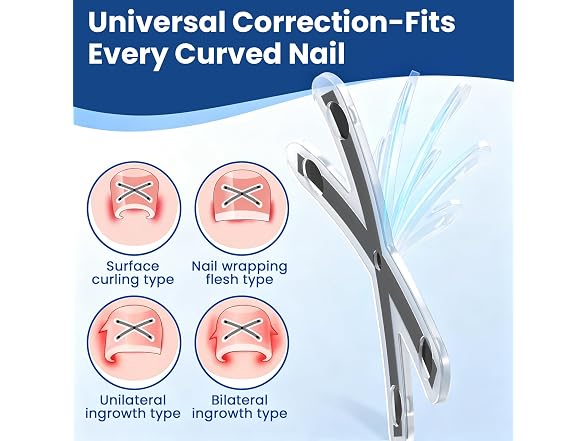 CosFancy Ingrown Toenail Treatment Kit