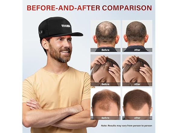 FIVORRA Hair Growth Red Light Cap
