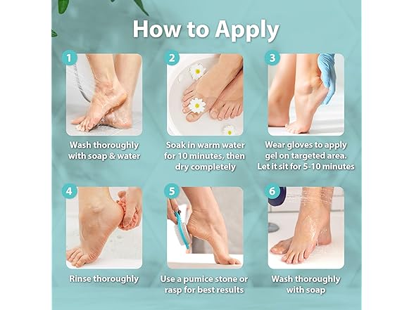 Ebanel Callus Remover Gel for Feet 20% Urea