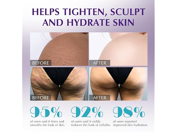 Anti-Cellulite Massager