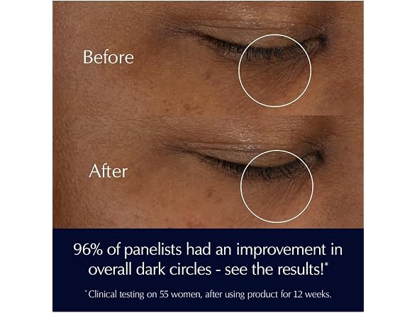 Estee Lauder Advanced Night Repair Eye