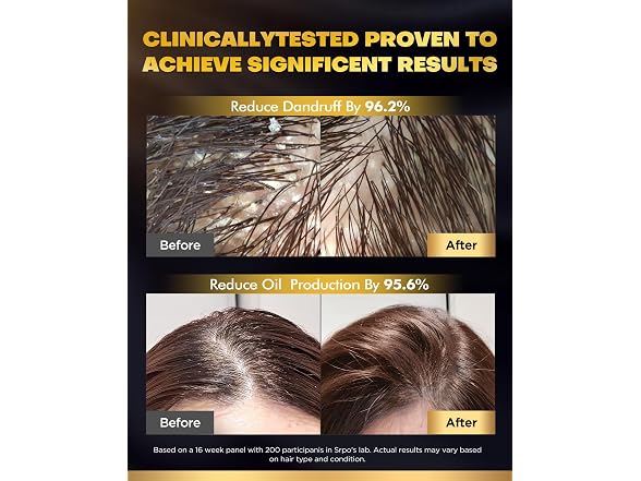COOLKESI Tripeptide-Infused Biotin Hair