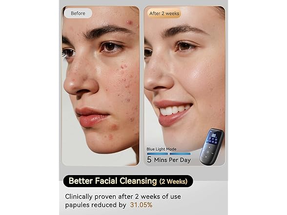 Sobetuar Red Light Therapy Face Mask