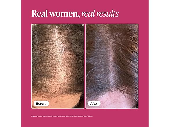 Viviscal Hair Growth Supplements 180Ct