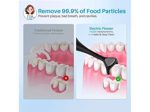 Electric Flosser