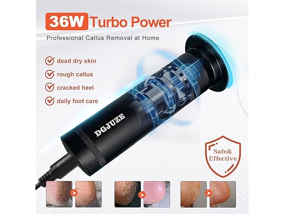 Electric Foot Callus Remover